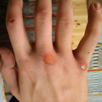 I only hit a boxing bag :D

#my #hand #is #hurt #stupid #but #no #pain #benefit #eikipuueihyötyy